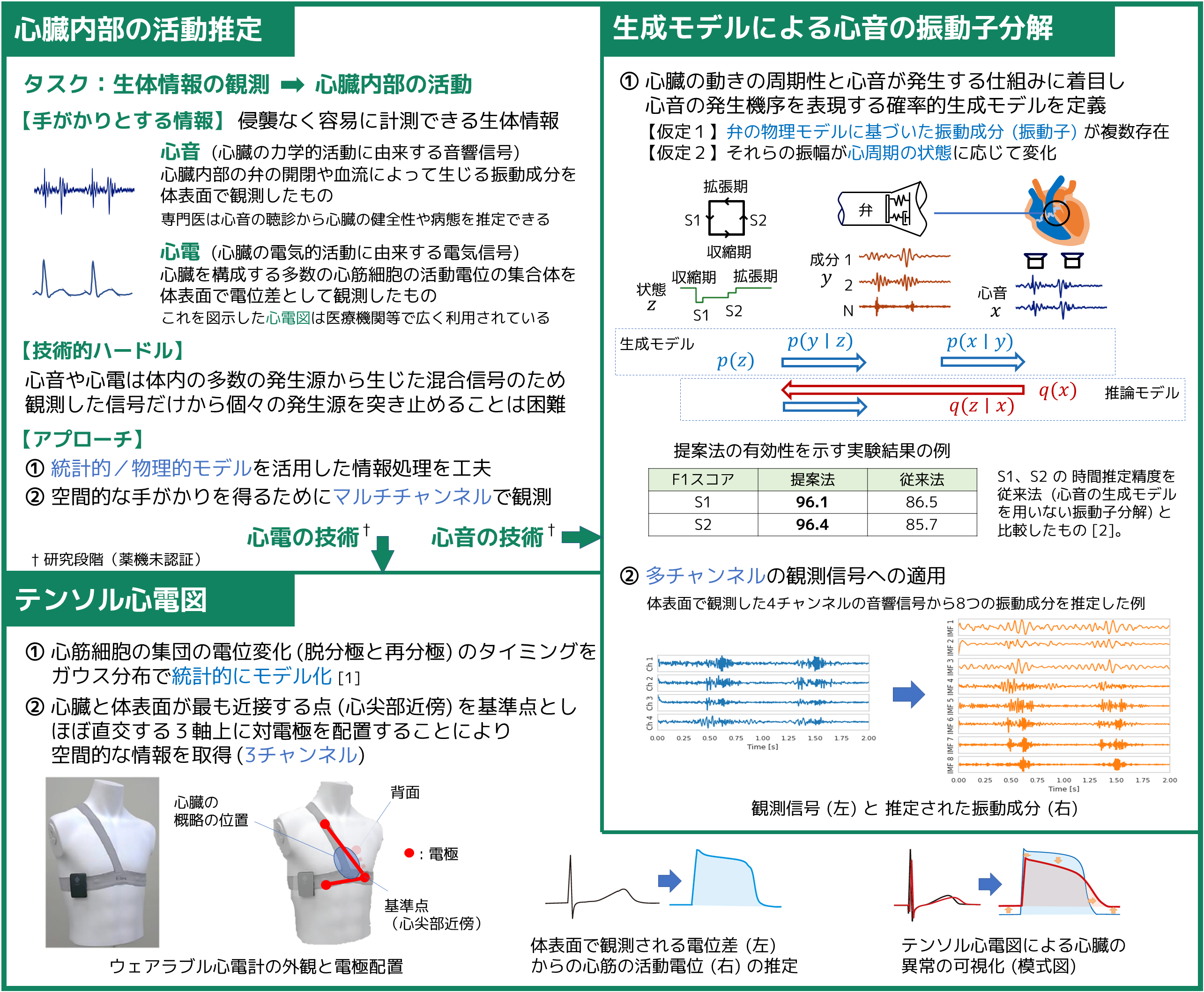 音と電気の信号で心臓の働きを見守ります