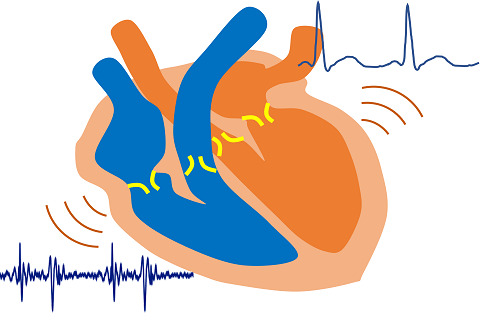 音と電気の信号で心臓の働きを見守ります